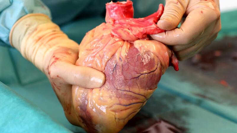 Neues Organspende-Register: Die wichtigsten Fragen und Antworten zum Start Ein Transplantationsmediziner hält in der Pathologie des Südstadt-Klinikums das Herz eines Verstorbenen in den Händen, das kurz zuvor entnommen wurde.