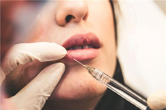 Eine 35-Jährige wird wegen gefährlicher Körperverletzung angeklagt. Sie spritzte Betroffenen Hyaluron in den meisten Fällen für Lippenvergrößerungen. Foto: unsplash