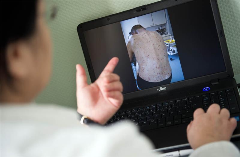 Eine Ärztin schaut sich einen von Krätze befallenen Patienten auf einem Laptop an. Symbolfoto: Daniel Naupold/dpa