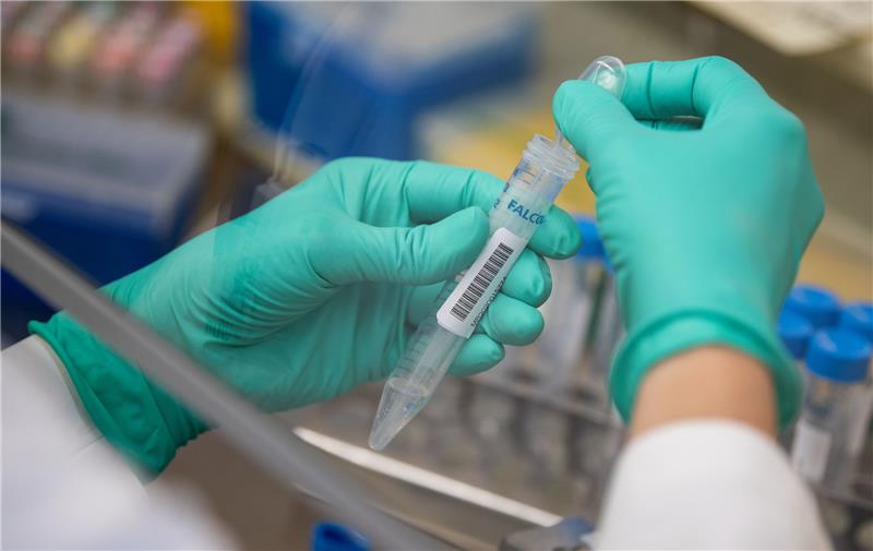 Eine Corona-Probe. Foto: Marijan Murat/dpa