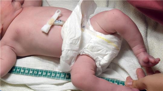 Eine Frau bringt ihr Baby im Auto zur Welt und wird in Krankenhaus nach Altona gebracht. (Symbolbild)