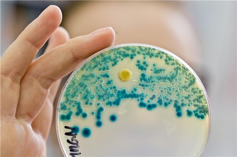 Eine Labormitarbeiterin hält eine Indikatorkulturplatte zum Nachweis von resistenten Bakterien in der Hand. Foto: Karmann/dpa