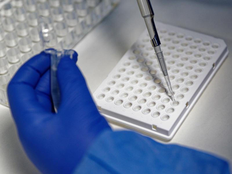Eine Mitarbeiterin des Labors CBT in Bonn füllt zur Vorbereitung von PCR-Tests eine Testflüssigkeit in eine Trägerplatte. Foto: Henning Kaiser/dpa