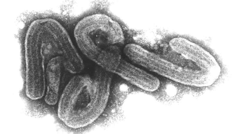 Ruanda erklärt Marburg-Virus-Ausbruch für beendet Eine elektronenmikroskopische Aufnahme des Marburg-Virus. (Archivbild)