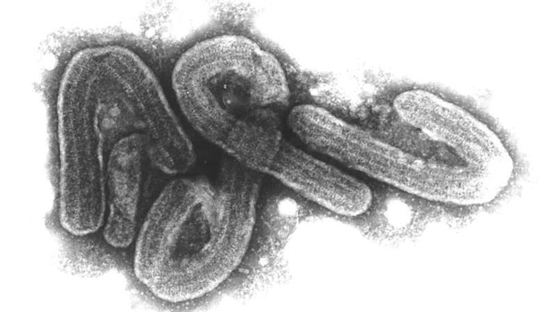 WHO: Offenbar acht Tote durch Marburg-Virus in Tansania Eine elektronenmikroskopische Aufnahme des Marburg-Virus.