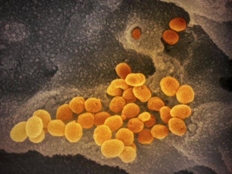 Corona-Inzidenz im Kreis Stade sinkt unter Wert von 60 Eine elektronenmikroskopische Aufnahme zeigt das neuartige Coronavirus, das aus der Oberfläche von im Labor kultivierten Zellen austritt. Foto: NIAID-RML/AP/dpa
