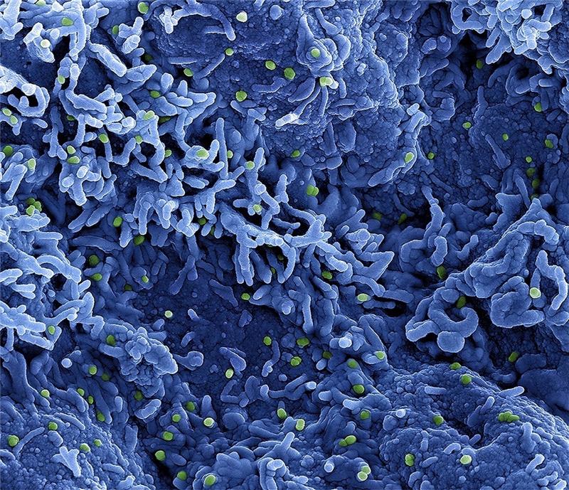 Eine kolorierte rasterelektronenmikroskopische Aufnahme des Affenpockenvirus (grün) auf der Oberfläche von infizierten VERO E6-Zellen (blau), aufgenommen in der NIAID Integrated Research Facility. Foto: Niaid/Niaid/Planet Pix via ZUMA Press Wire/dpa