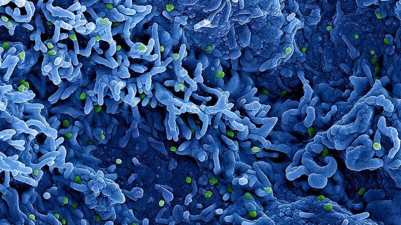 WHO ruft wegen Mpox weltweite Notlage aus Eine kolorierte rasterelektronenmikroskopische Aufnahme des Affenpockenvirus (grün) auf der Oberfläche von infizierten VERO E6-Zellen (blau), aufgenommen in der NIAID Integrated Research Facility, veröffentlicht am 26. Juli 2022 in Fort Detrick, Maryland.