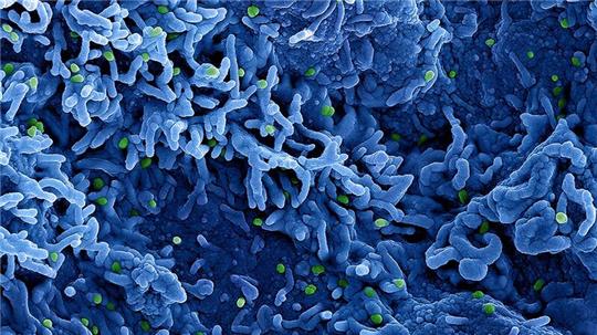 Eine kolorierte rasterelektronenmikroskopische Aufnahme des Affenpockenvirus (grün) auf der Oberfläche von infizierten VERO E6-Zellen (blau), aufgenommen in der NIAID Integrated Research Facility, veröffentlicht am 26. Juli 2022 in Fort Detrick, Maryland.