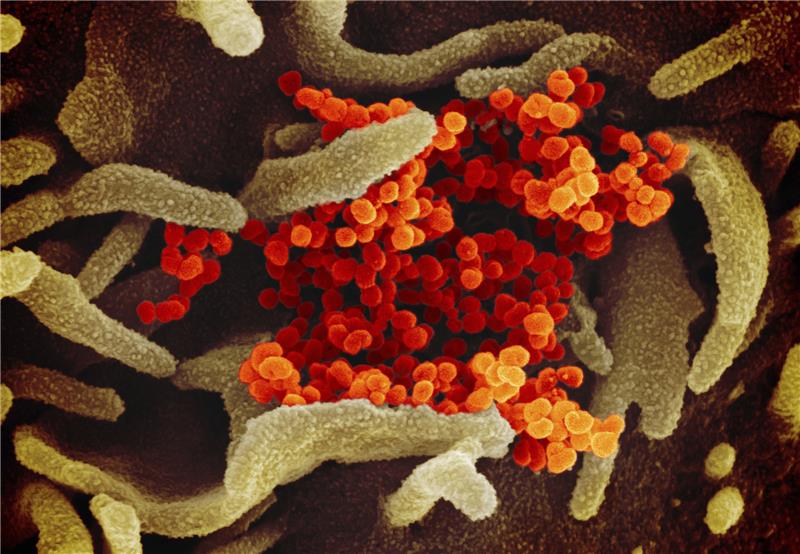 Eine undatierte elektronenmikroskopische Aufnahme des «U.S. National Institute of Health» zeigt das neuartige Coronavirus (SARS-CoV-2) (orange), das aus der Oberfläche von im Labor kultivierten Zellen (grau) austritt. Die Probe wurde von einem Patienten in den USA isoliert. Sehen kann man das Coronavirus nur unter einem speziellen Mikroskop, das es sehr stark vergrößert.