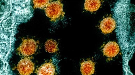 Elektronenmikroskopische Aufnahme des Coronavirus SARS-CoV-2.