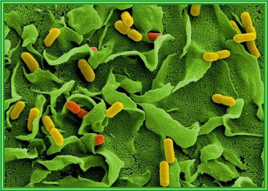 Elektronenmikroskopische Aufnahmen von Listerien (Listeria monocytogenes) auf der Oberfläche einer dendritischen Zelle.