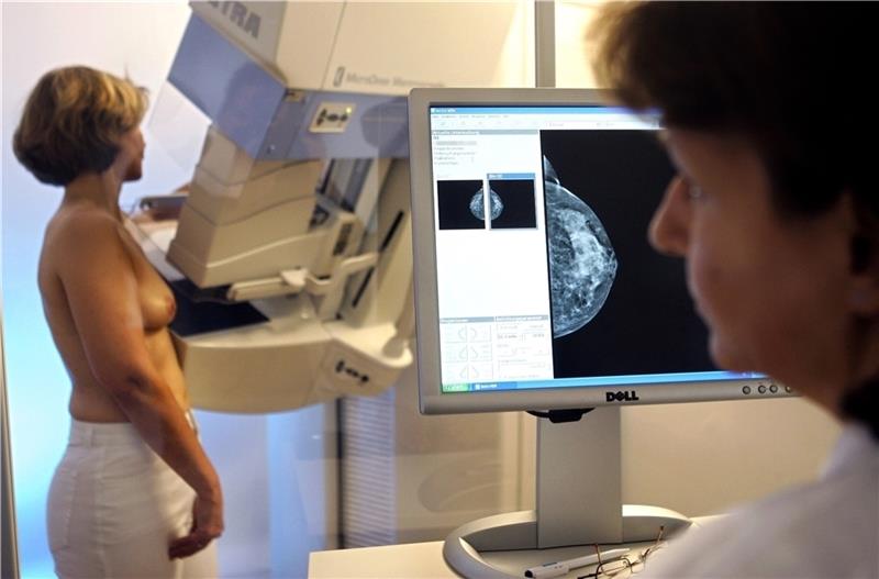 „Es gibt derzeit keine Alternative zur Mammografie “, sagt Thilo Töllner. Für Frauen ab 50 Jahren ist dieses Angebot der Vorsorge kostenlos, viele Betroffene nutzen es dennoch nicht. Foto: dpa