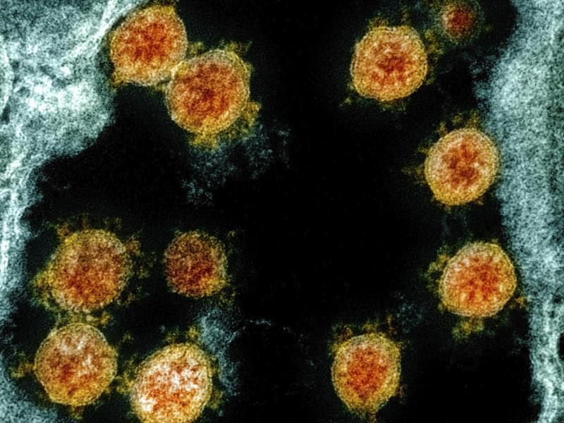 Experten gehen davon aus, dass wir das Coronavirus Sars-CoV-2 nicht so schnell loswerden. Foto: Uncredited/NIAID/NIH/dpa