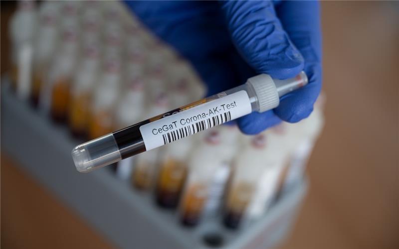 Für die Tests werden Blutproben analysiert. Foto: Marijan Murat/dpa