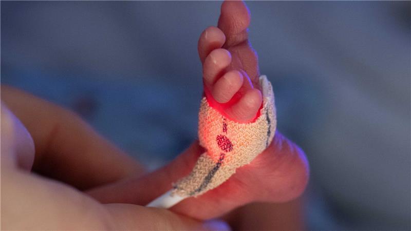 Drei Länder wollen schärfere Regeln für Frühchen kippen Für die Versorgung von Frühgeborenen gibt es Mindestmengen, die Krankenhäuser erreichen müssen, um die Behandlung bezahlt zu bekommen. Drei Bundesländer sehen dadurch ihre Rechte verletzt und klagen in Karlsruhe. (Archivbild)