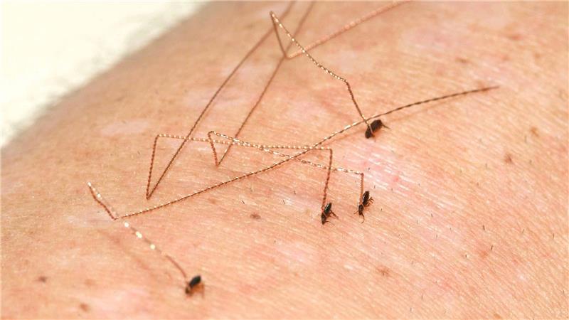 Fütterungszeit auf Birks Arm: Die Floh-Garde stärkt sich vor dem Auftritt.