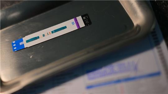 HIV-Diagnosen werden oft erst Jahre nach der Infektion gestellt. (Symbolbild)