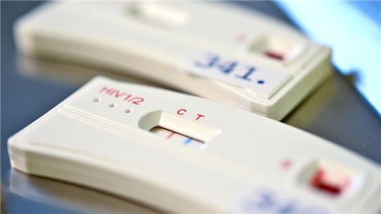 HIV-Schnelltests zeigen an, ob jemand das Virus in sich trägt. (Archivbild)