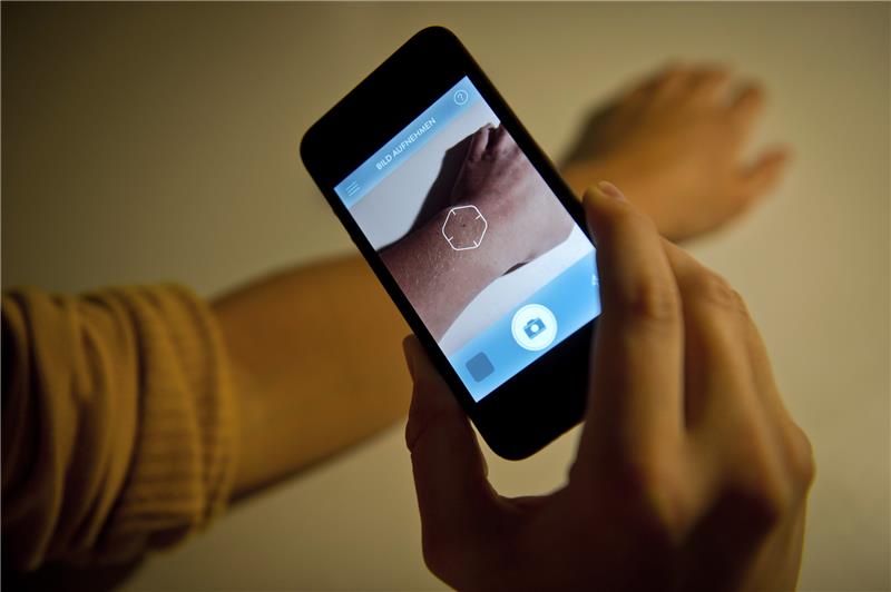 Hautscreening-Apps können die Krebsfrüherkennung beim Hautarzt nicht ersetzen. Aber: Viele Hautveränderungen beurteilen sie korrekt. Foto: dpa/tmn