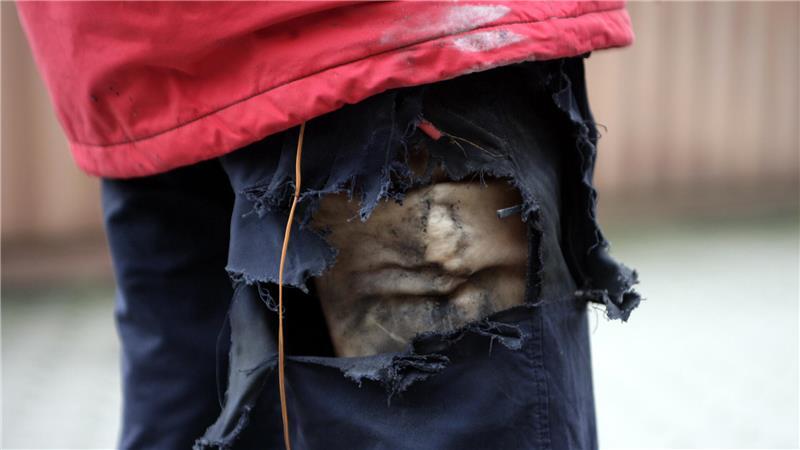 Hohe Verletzungsgefahr, sollten sie zünden: Böller und Co. gehören nicht in Hosen oder Jackentaschen.