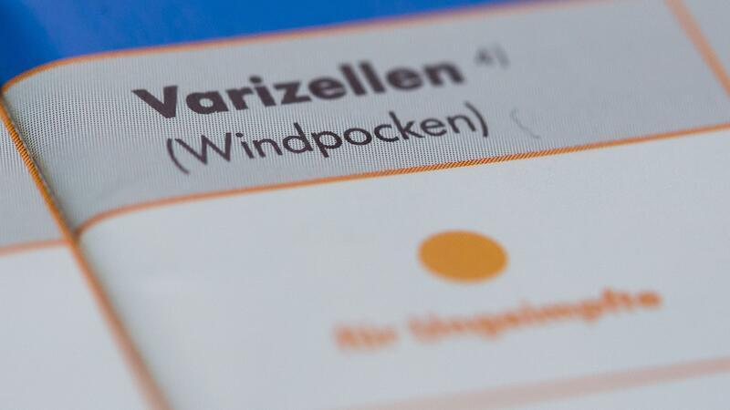 Impfungen können vor Windpocken-Ansteckungen schützen. (Archivbild)