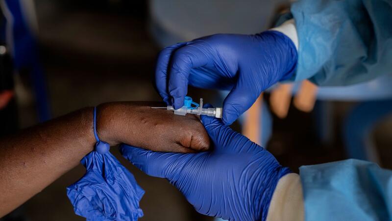 Lockdowns, Massen-Impfungen und Ausgangssperren wegen Mpox? In afrikanischen Ländern wie hier in der Demokratischen Republik Kongo sind Impfungen gegen die Affenpocken lebensnotwendig. (Archivbild)