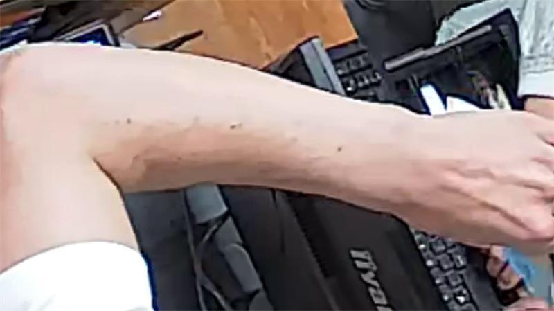 In dem Screenshot der Überwachungsbilder fallen beim Täter zudem die Muttermale auf dem Arm auf.