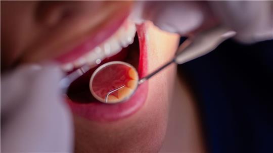 In den Städten in Schleswig-Holstein gibt es viele Zahnarztpraxen. (Symbolbild)