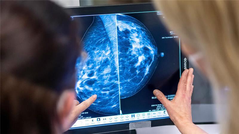 In der Mammografie wird unter anderem auf Brustkrebs untersucht.