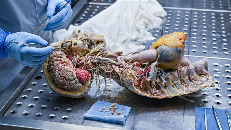 „So gekämpft für mich“: Frau erhält nach Transplantation ihr Herz zurück In der Werkstatt im brandenburgischen Guben entstehen die Plastinate der Organe. (Archivbild)