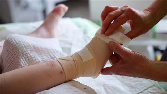 Käthe unterzieht sich dem täglichen, zweistündigen Verbandswechsel. Die Vierjährige leidet an Epidermolysis bullosa.