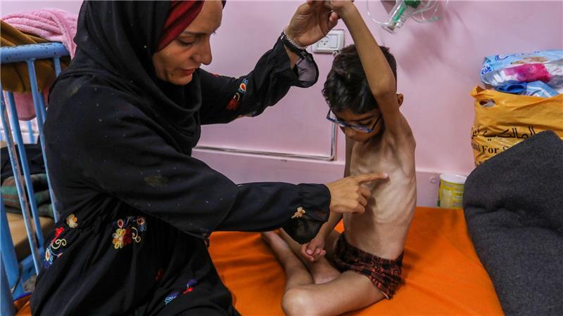 Hungersnot in Gaza erklärt - Israel droht mit Zerstörung Kinder unter fünf Jahren sind bei Mangelernährung in Lebensgefahr. (Archivbild)