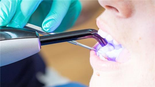 Laut KZBV-Vorstandschef Hendges gehen bei fachgerechtem Einsatz von Dentalamalgam keine Gesundheitsgefahren aus.