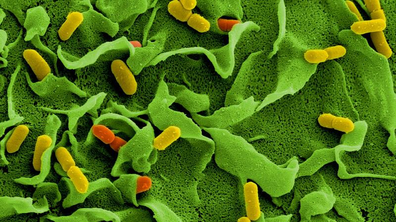 Listerien sind in Geflügelfleischwurst gefunden worden, die unter anderem in Edeka-Supermärkten verkauft wurde (Archivbild).