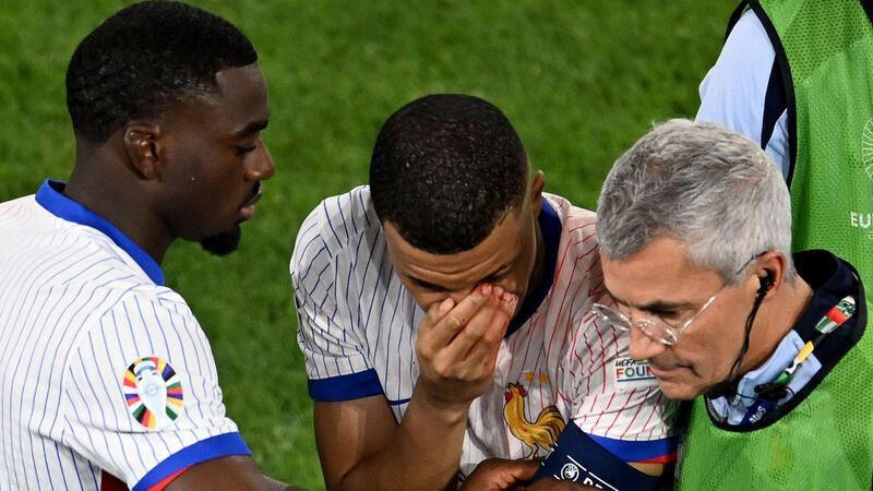 Frankreich und die Folgen von Mbappés Nasenbeinbruch Mbappé (M) musste mit stark blutender Nase ausgewechselt werden.