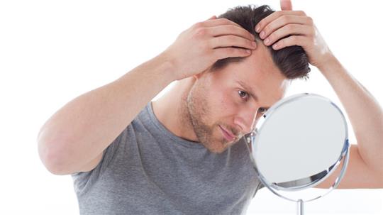 Mit Geheimratsecken fängt es oft an: Das Thema Haarverlust beschäftigt viele Männer. 