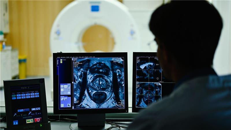 Nach dem Anfangsverdacht auf Prostatakrebs kommen im Verlauf einer Diagnostik auch bildgebende Verfahren zum Einsatz. (Archivbild)