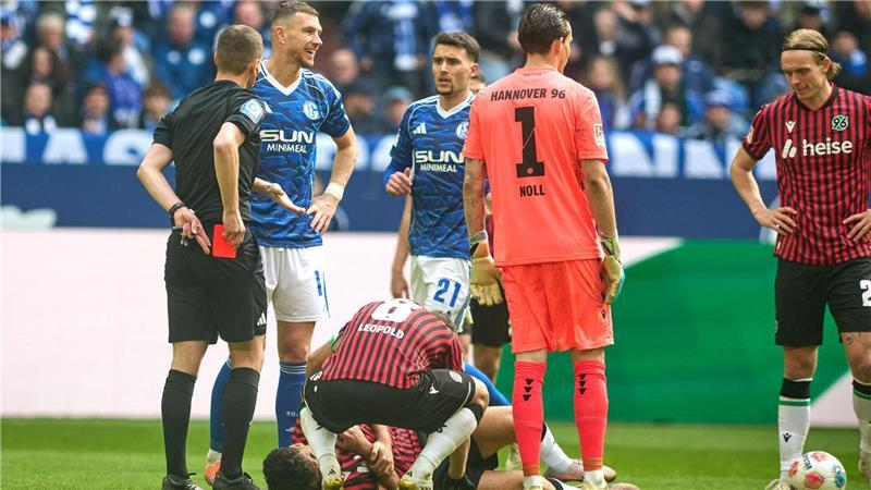 Nachdem er den Hannoveraner Husseyn Chakroun mit dem hohen Fuß getroffen hatte, wurde Edin Dzeko des Feldes verwiesen.