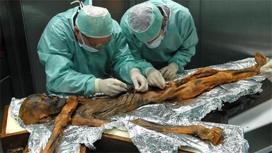 Ötzi wurde hundertfach untersucht