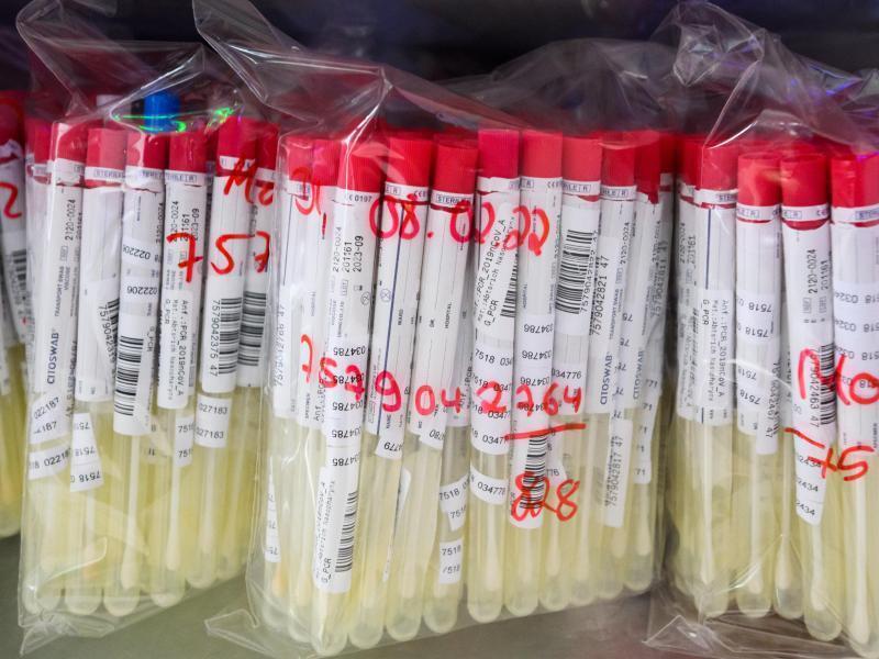 Ab sofort gelten neue PCR-Tests-Regeln PCR-Tests einem im Labor. Foto: Julian Stratenschulte/dpa