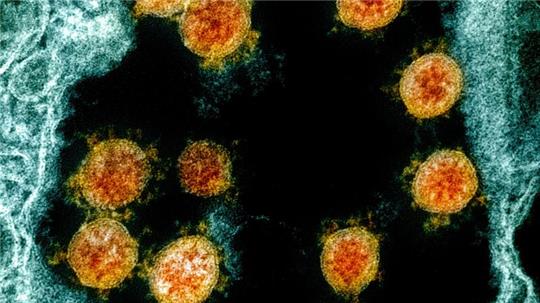 Partikel des Coronavirus SARS-CoV-2 wurden für eine elektronenmikroskopische Aufnahme farblich bearbeitet.