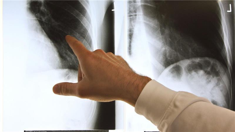 Patientenschützer sind über die geplanten Neuregelungen bei der Ärztewahl besorgt. (Archivbild)