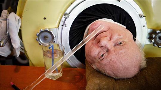 Paul Alexander war über 70 Jahre auf eine eiserne Lunge angewiesen, nun ist er gestorben.