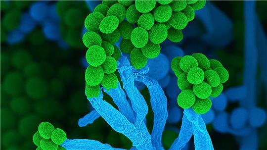 Penicillium bedeutet auf Lateinisch „kleiner Pinsel“, weil die Zellketten mit Sporen am Ende so ähnlich aussehen (Handout)