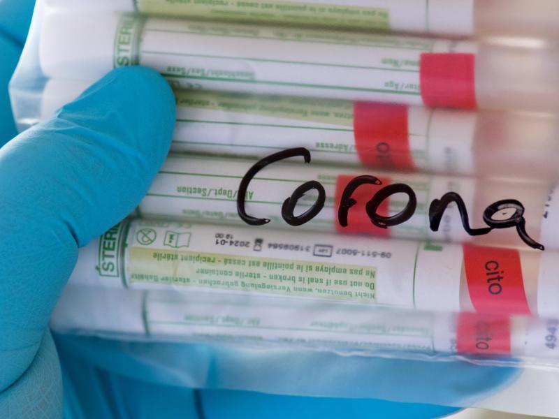 Proben für Corona-Tests werden einem Labor für die weitere Untersuchung vorbereitet. Foto: Hendrik Schmidt/dpa-Zentralbild/ZB/Symbolbild