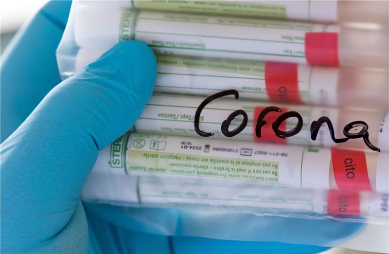 Proben für Corona-Tests werden im Diagnosticum-Labor in Plauen für die weitere Untersuchung vorbereitet.