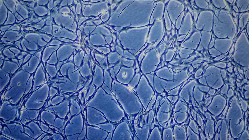Proben kultivierter Fischzellen sind auf einem Monitor eines Mikroskops zu sehen. (Archivbild)