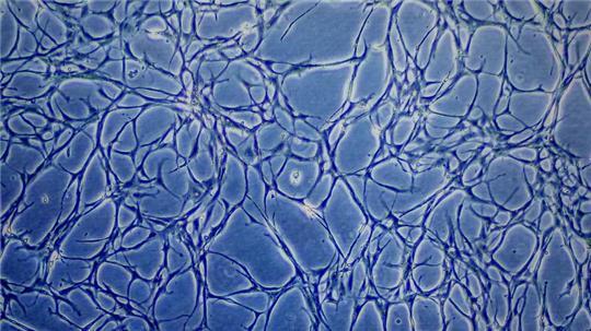 Proben kultivierter Fischzellen sind auf einem Monitor eines Mikroskops zu sehen. (Archivbild)