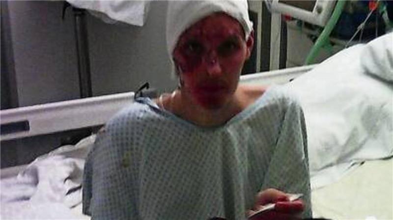 René Nickel beim Essen auf der Intensivstation in Hamburg. Er sagt, selbst in dem Spezial-Krankenhaus war er aufgrund seiner schweren Verletzungen „eine Attraktion“.